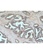 BCO2 Polyclonal antibody 14324-1-AP proteintech