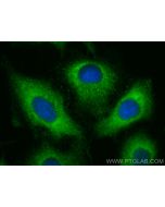 ARHGAP25 Polyclonal antibody 14349-1-AP proteintech