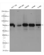CDT1 Polyclonal antibody 14382-1-AP proteintech