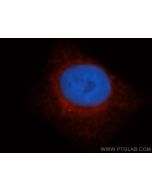 LDHD Polyclonal antibody 14398-1-AP proteintech