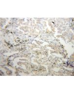 CHSY1 Polyclonal antibody 14420-1-AP proteintech
