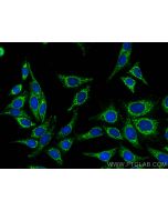 GLUD2 Polyclonal antibody 14462-1-AP proteintech
