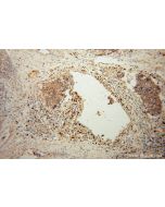 AIG1 Polyclonal antibody 14468-1-AP proteintech