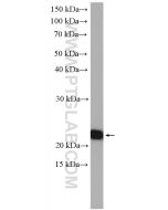 LZIC Polyclonal antibody 14543-1-AP proteintech
