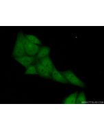 PSMB9 Polyclonal antibody 14544-1-AP proteintech