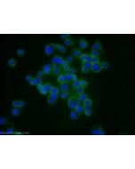 MMP14 / MT1-MMP Polyclonal antibody 14552-1-AP proteintech