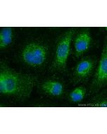DHRS9 Polyclonal antibody 14560-1-AP proteintech