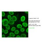 TMPO/LAP2 Polyclonal antibody 14651-1-AP proteintech