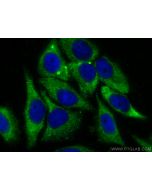RPL18A Polyclonal antibody 14653-1-AP proteintech