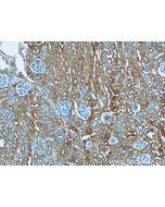 IVNS1ABP Polyclonal antibody 14741-1-AP proteintech