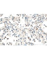 Hikeshi Polyclonal antibody 14808-1-AP proteintech