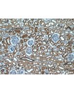 VIPR1 Polyclonal antibody 14878-1-AP proteintech