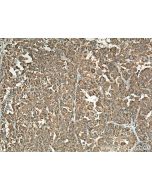 NARS Polyclonal antibody 14882-1-AP proteintech