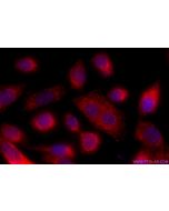KLHL12 Polyclonal antibody 14883-1-AP proteintech