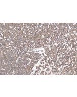 PECR Polyclonal antibody 14901-1-AP proteintech