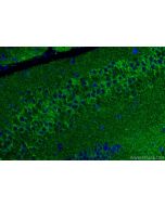 SUCLG1 Polyclonal antibody 14923-1-AP proteintech