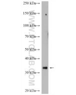 SNX11 Polyclonal antibody 14953-1-AP proteintech