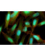 EXOSC3 Polyclonal antibody 15062-1-AP proteintech