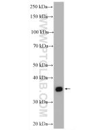 RIMS3 Polyclonal antibody 15088-1-AP proteintech