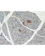 INPP5B Polyclonal antibody 15141-1-AP proteintech