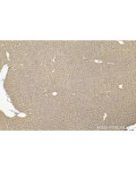 CRAT Polyclonal antibody 15170-1-AP proteintech