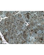 CA12 Polyclonal antibody 15180-1-AP proteintech
