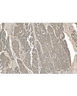 DDX19A Polyclonal antibody 15209-1-AP proteintech