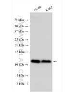 TCTA Polyclonal antibody 15221-1-AP proteintech
