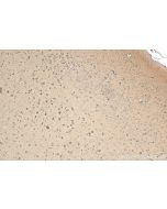 KIF1B Polyclonal antibody 15263-1-AP proteintech