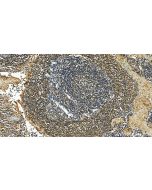 IFN-gamma Polyclonal antibody 15365-1-AP proteintech