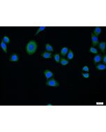 SURF1 Polyclonal antibody 15379-1-AP proteintech