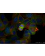 Anti-Human Survivin Rabbit Recombinant Antibody Proteintech  98624-1-RR