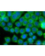 AKR1B1 Polyclonal antibody 15439-1-AP proteintech