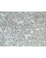 SAR1B Polyclonal antibody 15453-1-AP proteintech