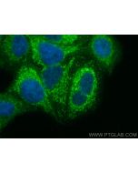 MCAT Polyclonal antibody 15536-1-AP proteintech