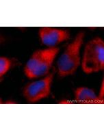 PRPS1 Polyclonal antibody 15549-1-AP proteintech