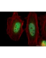 PCGF1 Polyclonal antibody 15581-1-AP proteintech