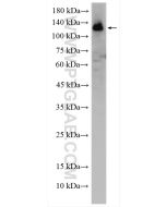 RNF40 Polyclonal antibody 15621-1-AP proteintech