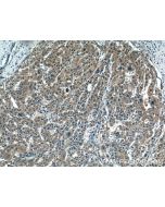 PMVK Polyclonal antibody 15674-1-AP proteintech