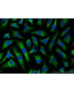 NDUFS7 Polyclonal antibody 15728-1-AP proteintech