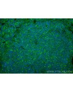 HLA-DRB4 Polyclonal antibody 15733-1-AP proteintech