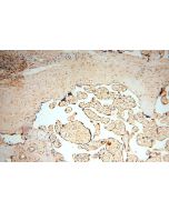 VAC14 Polyclonal antibody 15771-1-AP proteintech