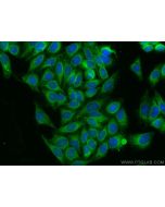 ATF6B Polyclonal antibody 15794-1-AP proteintech