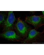 Carboxypeptidase A1 Polyclonal antibody 15836-1-AP proteintech