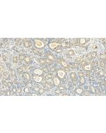 RPS11 Polyclonal antibody 15942-1-AP proteintech