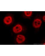 FIBP Polyclonal antibody 15968-1-AP proteintech