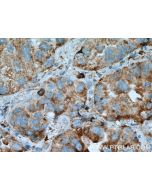 PRCP Polyclonal antibody 15995-1-AP proteintech