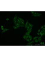 LAS1L Polyclonal antibody 16010-1-AP proteintech