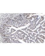 ILKAP Polyclonal antibody 16017-1-AP proteintech