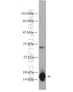 Cystatin SN/CST1 Polyclonal antibody 16025-1-AP proteintech